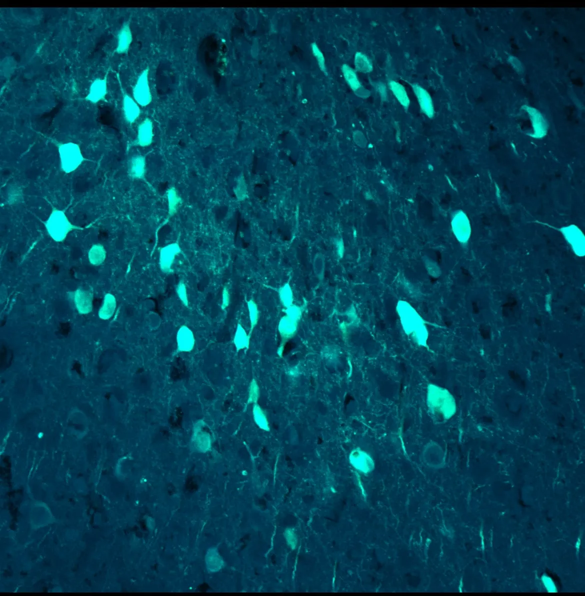 Fluorescence micrograph from the Izquierdo Lab: labelled projection neurons glowing cyan in rat frontal cortex.