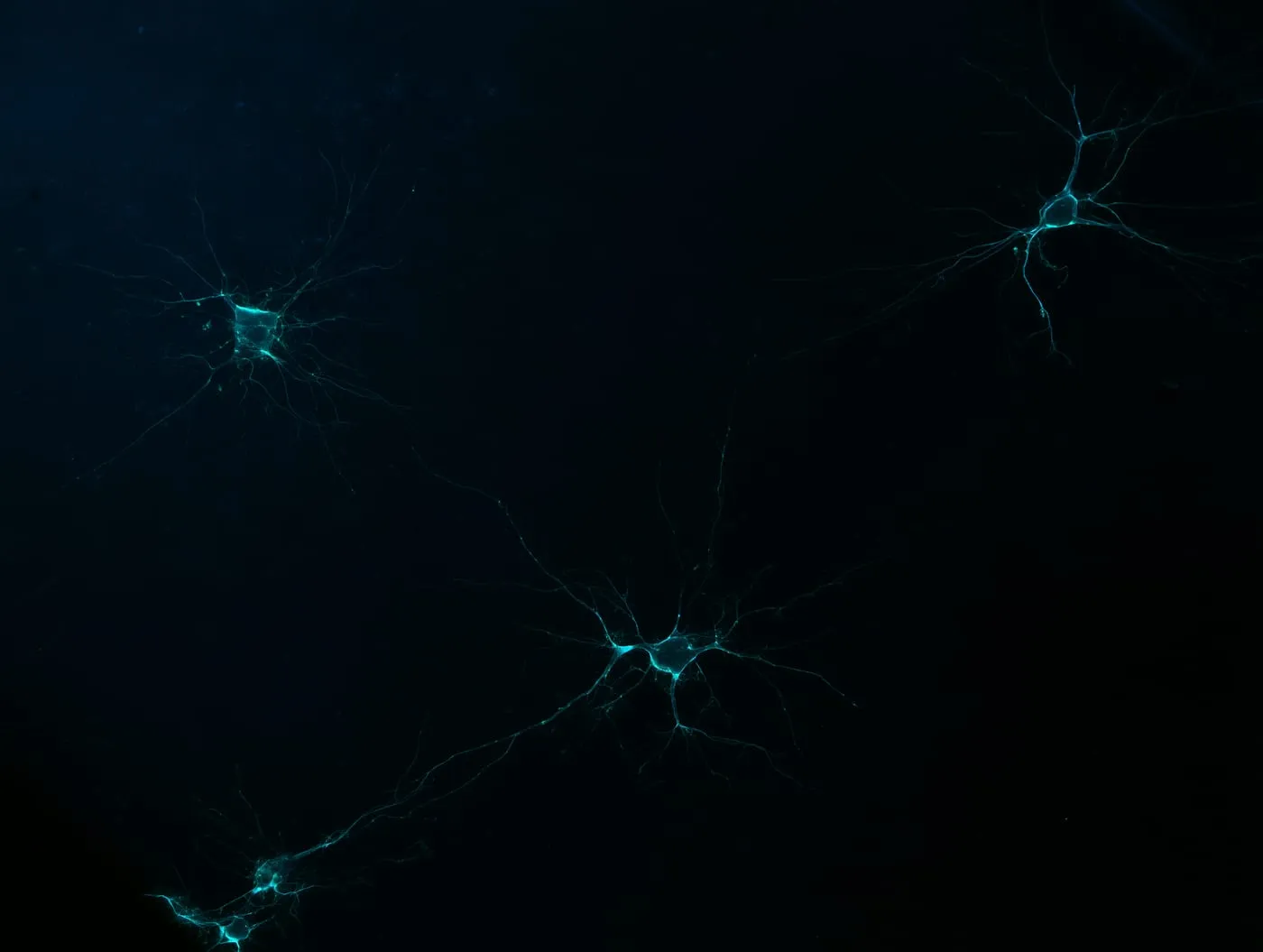 A few dim neurons with thin glowing processes, scattered far apart in darkness.
